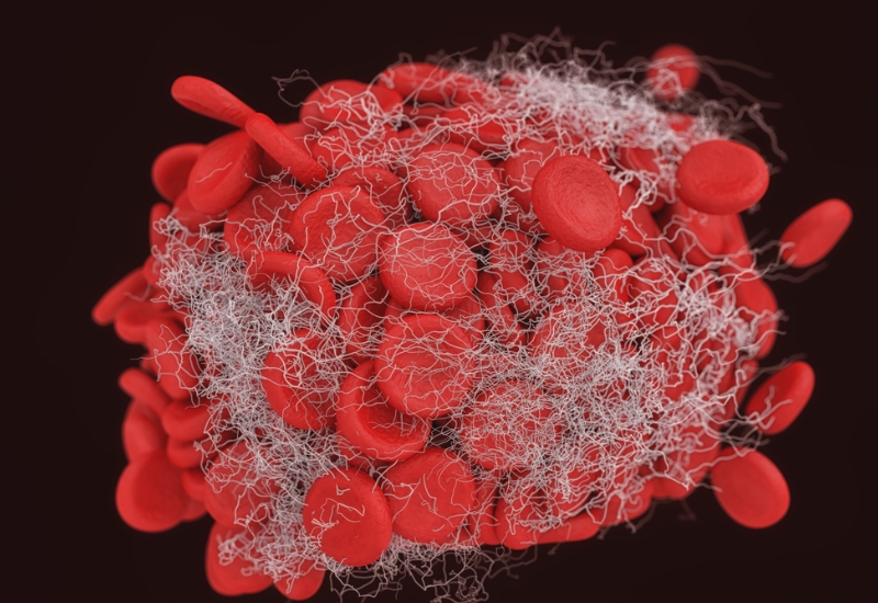 lợi ích của việc phát hiện bệnh hemophilia