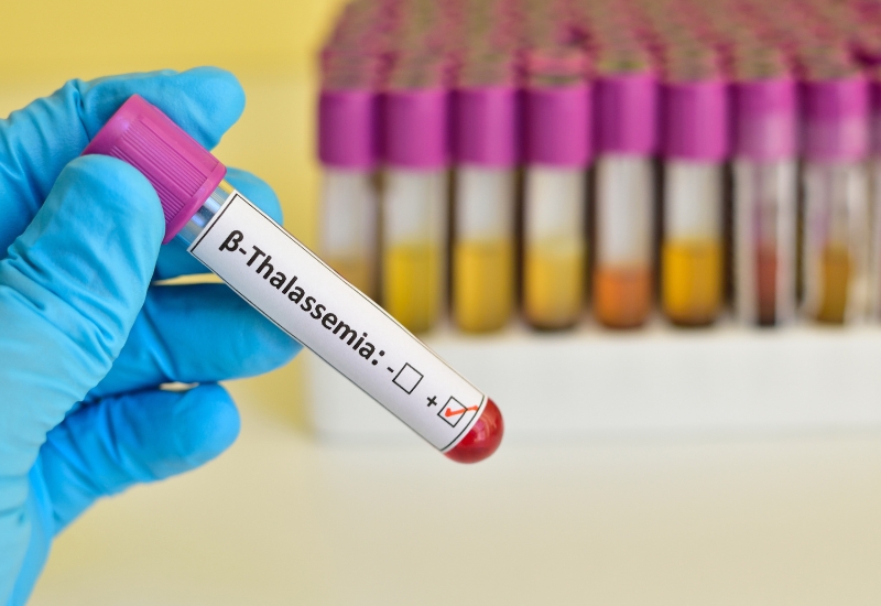 gen thalassemia là gì