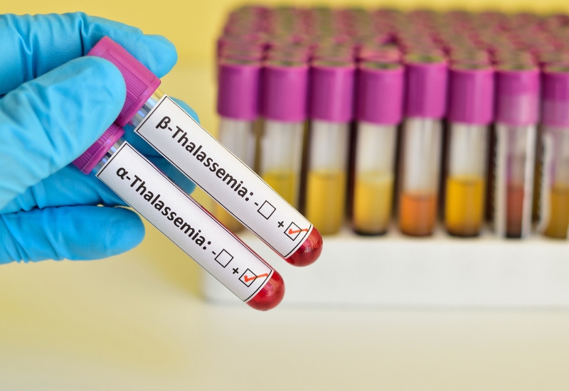 gen thalassemia đối với phụ nữ mang thai