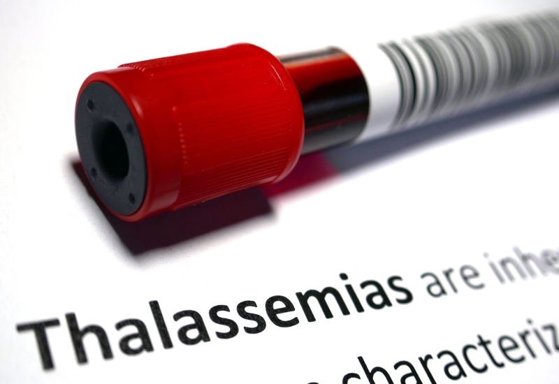 lưu ý về bệnh gen thalassemia