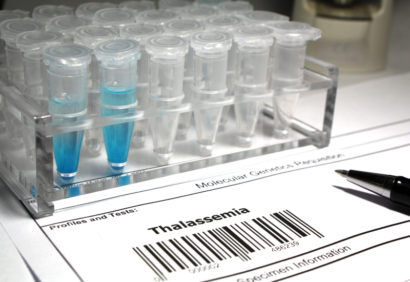 tỉ lệ mang gen thalassemia